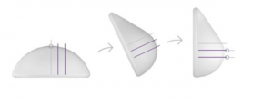 Teardrop Implants v Round Implants - Red Rose Desire Cosmetic Surgery
