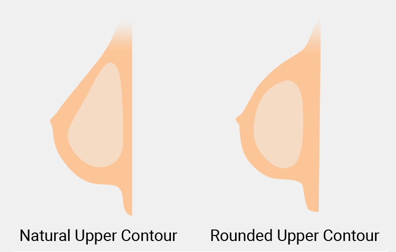 Teardrop Implants v Round Implants - Red Rose Desire Cosmetic Surgery