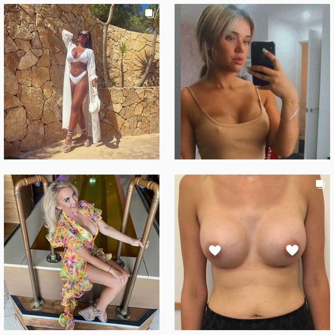 Patients Breast Surgery